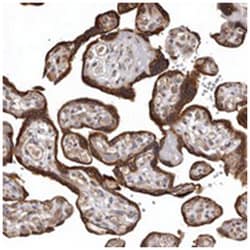 FAM212B Rabbit anti-Human, Polyclonal Antibody, Abnova 100 &mu;L | Buy Online | Abnova Corporation | Fisher Scientific