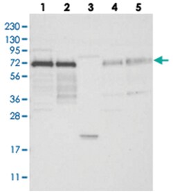 IRF2BP2 Rabbit anti-Human, Polyclonal Antibody, Abnova 100 &mu;L | Buy Online | Abnova Corporation | Fisher Scientific