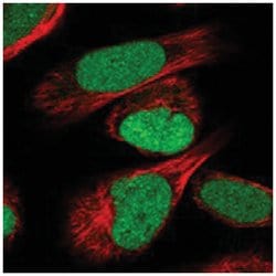 IRF2BP2 Rabbit anti-Human, Polyclonal Antibody, Abnova 100 &mu;L | Buy Online | Abnova Corporation | Fisher Scientific