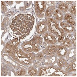 LOC100505603, Rabbit, Polyclonal Antibody, Abnova 100 &mu;L | Buy Online | Abnova Corporation | Fisher Scientific