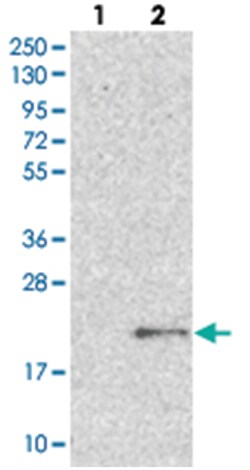 LOC100505603, Rabbit, Polyclonal Antibody, Abnova 100 &mu;L | Buy Online | Abnova Corporation | Fisher Scientific