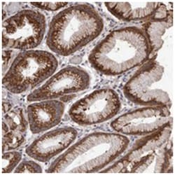 NAV1 Rabbit anti-Human, Polyclonal Antibody, Abnova 100&mu;L; Unlabeled:Antibodies,