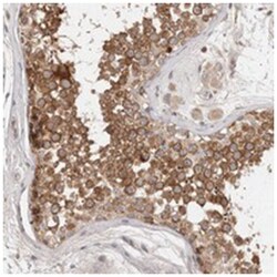 DOPEY1 Rabbit anti-Human, Polyclonal Antibody, Abnova 100&mu;L; Unlabeled:Antibodies,