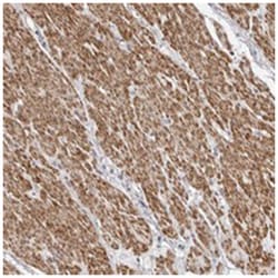 UNK Rabbit anti-Human, Polyclonal Antibody, Abnova 100&mu;L; Unlabeled:Antibodies,