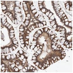 CCDC18, Rabbit, Polyclonal Antibody, Abnova 100 &mu;L | Buy Online | Abnova Corporation | Fisher Scientific