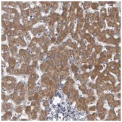 LYSMD1, Rabbit, Polyclonal Antibody, Abnova 100 &mu;L | Buy Online | Abnova Corporation | Fisher Scientific