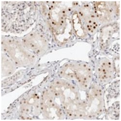 HIPK3, Rabbit, Polyclonal Antibody, Abnova 100&mu;L; Unlabeled:Antibodies,