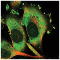 HIPK3, Rabbit, Polyclonal Antibody, Abnova 100&mu;L; Unlabeled:Antibodies,