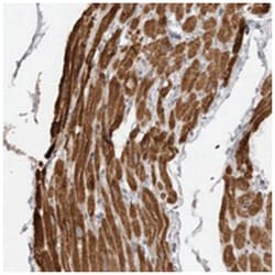 MAP7D1, Rabbit, Polyclonal Antibody, Abnova 100&mu;L; Unlabeled:Antibodies,