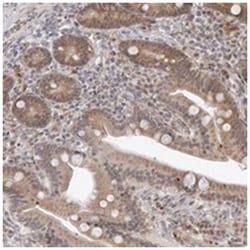 ODF2L Rabbit anti-Human, Polyclonal Antibody, Abnova 100 &mu;L | Buy Online | Abnova Corporation | Fisher Scientific
