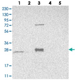 MRPS15 Rabbit anti-Human, Polyclonal Antibody, Abnova 100&mu;L; Unlabeled:Antibodies,