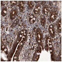 MRPS15 Rabbit anti-Human, Polyclonal Antibody, Abnova 100&mu;L; Unlabeled:Antibodies,