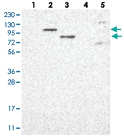 PARP10, Rabbit, Polyclonal Antibody, Abnova 100&mu;L; Unlabeled:Antibodies,