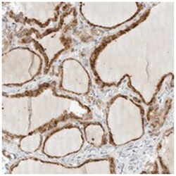 PARP10, Rabbit, Polyclonal Antibody, Abnova 100&mu;L; Unlabeled:Antibodies,