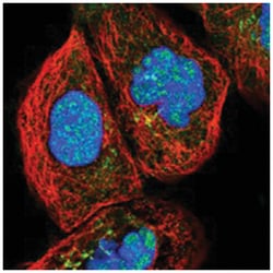 PARP10, Rabbit, Polyclonal Antibody, Abnova 100&mu;L; Unlabeled:Antibodies,