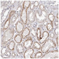 ZYG11B, Rabbit, Polyclonal Antibody, Abnova 100 &mu;L | Buy Online | Abnova Corporation | Fisher Scientific