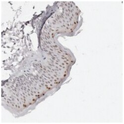 CASZ1 Rabbit anti-Human, Polyclonal Antibody, Abnova 100&mu;L; Unlabeled:Antibodies,