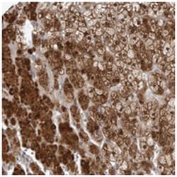 KIAA1614, Rabbit, Polyclonal Antibody, Abnova 100&mu;L; Unlabeled:Antibodies,