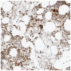 ZNF407, Rabbit, Polyclonal Antibody, Abnova 100&mu;L; Unlabeled:Antibodies,