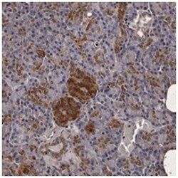 PARS2, Rabbit, Polyclonal Antibody, Abnova 100 &mu;L | Buy Online | Abnova | Fisher Scientific