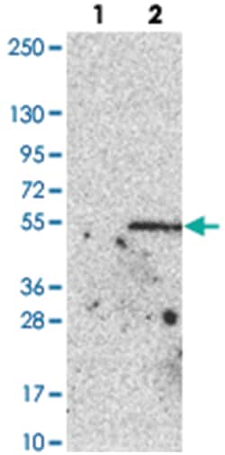 PARS2, Rabbit, Polyclonal Antibody, Abnova 100 &mu;L | Buy Online | Abnova | Fisher Scientific