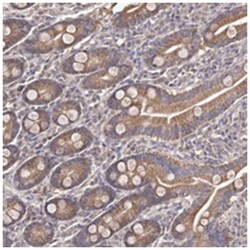 ODF2L Rabbit anti-Human, Polyclonal Antibody, Abnova 100&mu;L; Unlabeled:Antibodies,