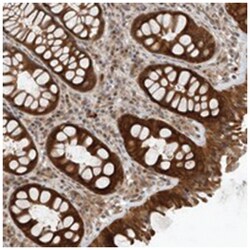 FAM63A, Rabbit, Polyclonal Antibody, Abnova 100 &mu;L | Buy Online | Abnova Corporation | Fisher Scientific