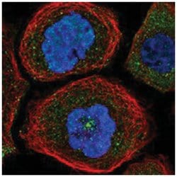 CEP350 Rabbit anti-Human, Polyclonal Antibody, Abnova 100 &mu;L | Buy Online | Abnova Corporation | Fisher Scientific