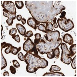 TCHH, Rabbit, Polyclonal Antibody, Abnova 100 &mu;L | Buy Online | Abnova Corporation | Fisher Scientific