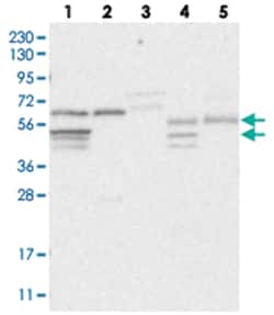 CPSF3L Rabbit anti-Human, Polyclonal Antibody, Abnova 100 &mu;L | Buy Online | Abnova Corporation | Fisher Scientific