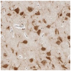 C1orf96, Rabbit, Polyclonal Antibody, Abnova 100 &mu;L | Buy Online | Abnova Corporation | Fisher Scientific