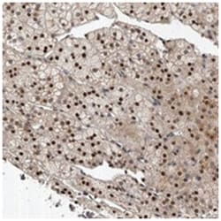 ABL1 Rabbit anti-Human, Polyclonal Antibody, Abnova 100 &mu;L | Buy Online | Abnova Corporation | Fisher Scientific