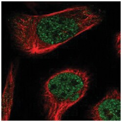 ABL1 Rabbit anti-Human, Polyclonal Antibody, Abnova 100 &mu;L | Buy Online | Abnova Corporation | Fisher Scientific