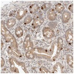 C17orf47, Rabbit, Polyclonal Antibody, Abnova 100 &mu;L | Buy Online | Abnova Corporation | Fisher Scientific