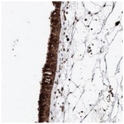 DNAH8, Rabbit, Polyclonal Antibody, Abnova 100&mu;L; Unlabeled:Antibodies,