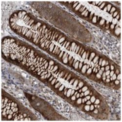 FAM102B, Rabbit, Polyclonal Antibody, Abnova 100&mu;L; Unlabeled:Antibodies,