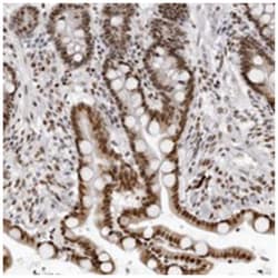 HEXIM2 Rabbit anti-Human, Polyclonal Antibody, Abnova 100 &mu;L | Buy Online | Abnova Corporation | Fisher Scientific