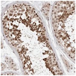 C1orf55 Rabbit anti-Human, Polyclonal Antibody, Abnova 100 &mu;L | Buy Online | Abnova Corporation | Fisher Scientific