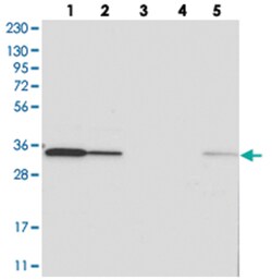 C1orf74, Rabbit, Polyclonal Antibody, Abnova 100μL; Unlabeled:Antibodies,
