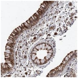 L1TD1 Rabbit anti-Human, Polyclonal Antibody, Abnova 100 &mu;L | Buy Online | Abnova | Fisher Scientific