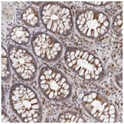 SERTAD4 Rabbit anti-Human, Polyclonal Antibody, Abnova 100 &mu;L | Buy Online | Abnova Corporation | Fisher Scientific
