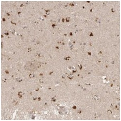 FAM211A, Rabbit, Polyclonal Antibody, Abnova 100 &mu;L | Buy Online | Abnova Corporation | Fisher Scientific