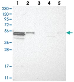 TRIM11, Rabbit, Polyclonal Antibody, Abnova 100 &mu;L | Buy Online | Abnova Corporation | Fisher Scientific