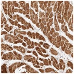 TRIM11, Rabbit, Polyclonal Antibody, Abnova 100 &mu;L | Buy Online | Abnova Corporation | Fisher Scientific