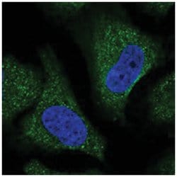 TRIM11, Rabbit, Polyclonal Antibody, Abnova 100 &mu;L | Buy Online | Abnova Corporation | Fisher Scientific