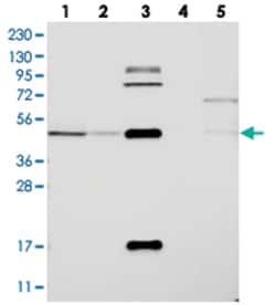 OTUD3 Rabbit anti-Human, Polyclonal Antibody, Abnova 100 &mu;L | Buy Online | Abnova Corporation | Fisher Scientific