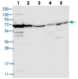 HSPA6, Rabbit, Polyclonal Antibody, Abnova 100 &mu;L | Buy Online | Abnova Corporation | Fisher Scientific