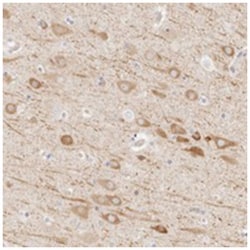 UBXN10 Rabbit anti-Human, Polyclonal Antibody, Abnova 100 &mu;L | Buy Online | Abnova Corporation | Fisher Scientific