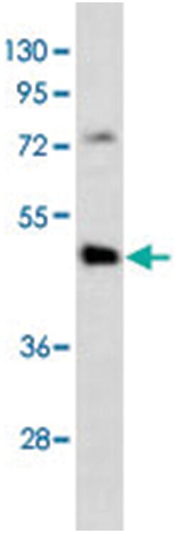 DNMT3L Rabbit anti-Human, Polyclonal Antibody, Abnova 400 &mu;L | Buy Online | Abnova Corporation | Fisher Scientific