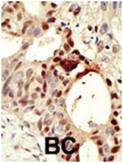 DNMT3L Rabbit anti-Human, Polyclonal Antibody, Abnova 400 &mu;L | Buy Online | Abnova Corporation | Fisher Scientific